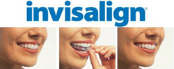 Ortodonzia con Invisalign